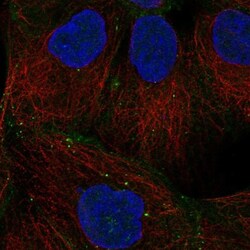Desmoglein-2 Antibody, Novus Biologicals:Antibodies:Primary Antibodies